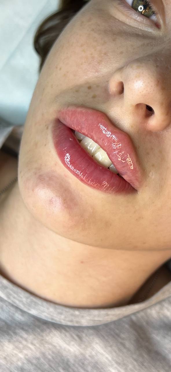 lip