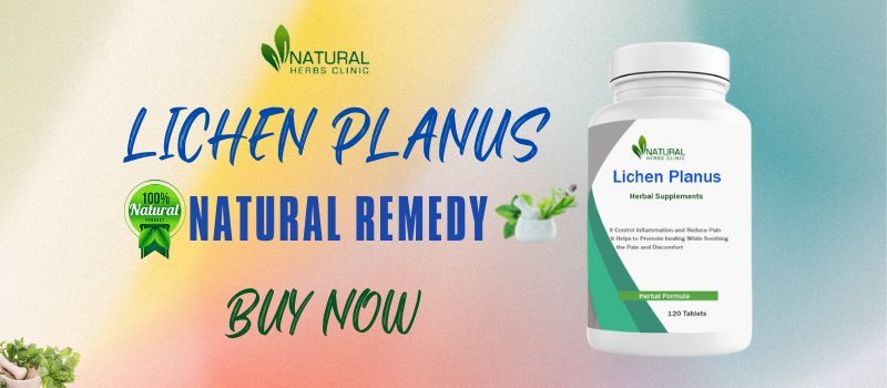 Herbal Treatments for Lichen Planus