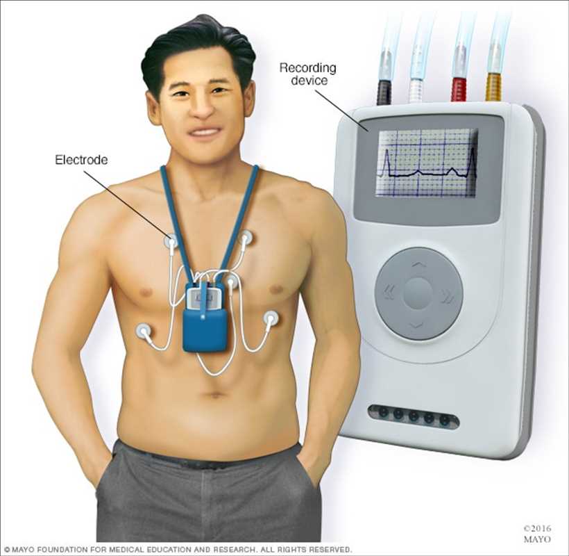 global Cardiac Holter Monitor market