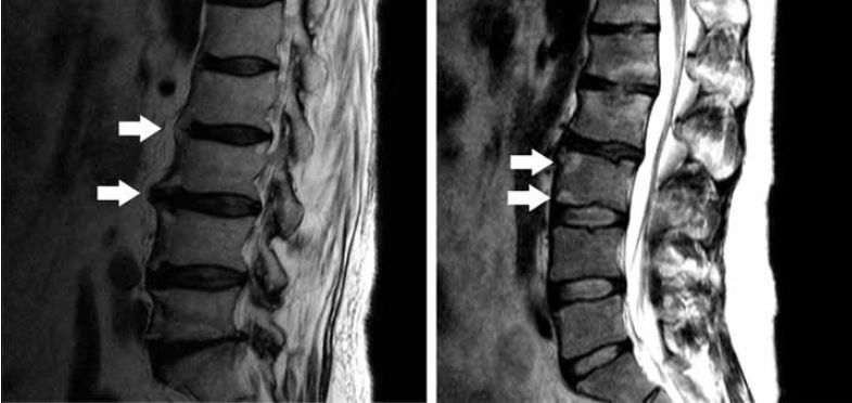 understanding-the-benefits-of-mri-lower-back-imaging-in-alamogordo