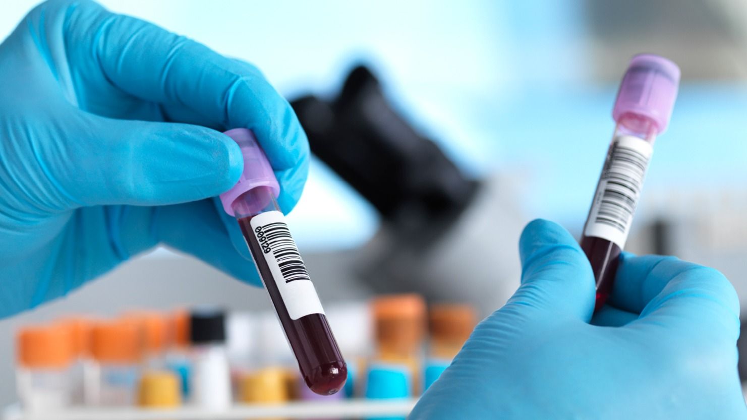 How to do a Book Lab Test at Home? Steve James Tealfeed