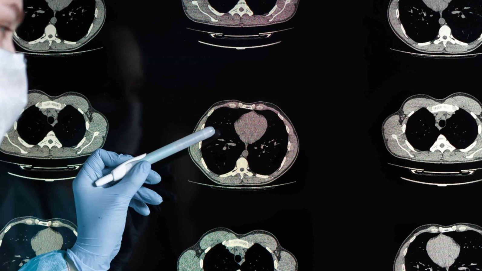 Exploring the Benefits and Limitations of CT Scans in Farmington